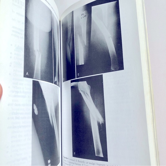 Vintage Book Pocket Companion to SABISTON TEXTBOOK of SURGERY 16th Ed Townsend - Picture 7 of 16